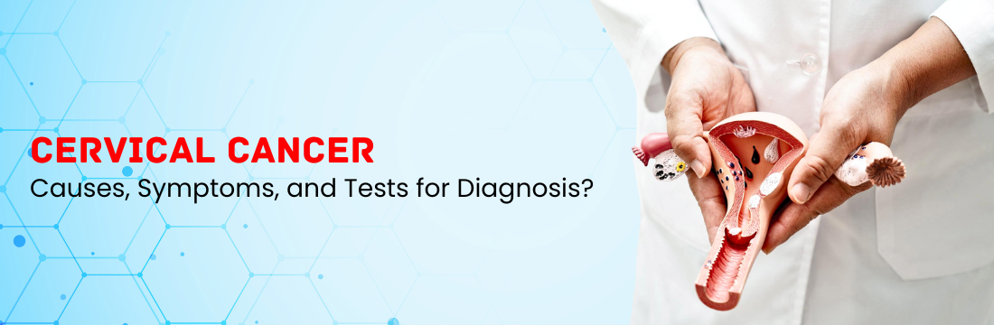 Cervical Cancer: What are its Causes, Symptoms, and Tests for Diagnosis?